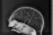 xray van ballon egel